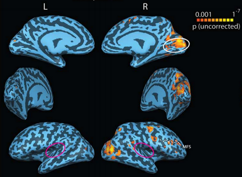 neural_correlates