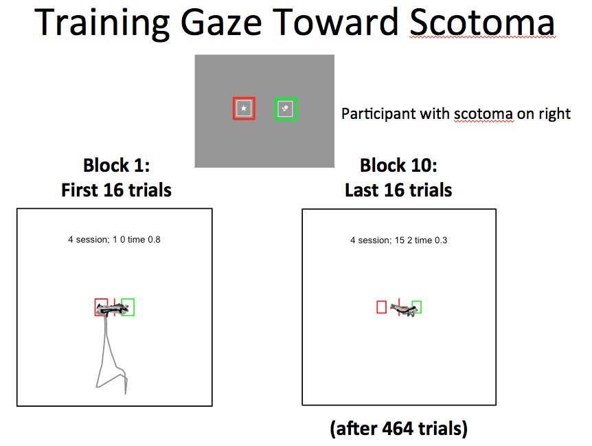 scotomaawarenesstraining1