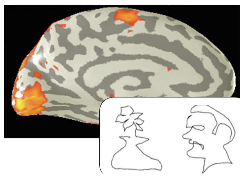 collage of a an fmri image of a brain and a pencil drawing of a flower in a vase and a man's face