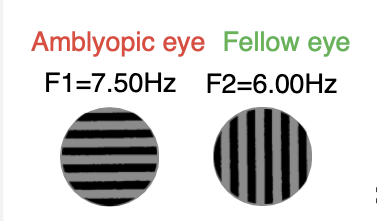 binocular rivalry